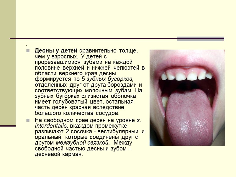 . Десны у детей сравнительно толще, чем у взрослых. У детей с прорезавшимися зубами